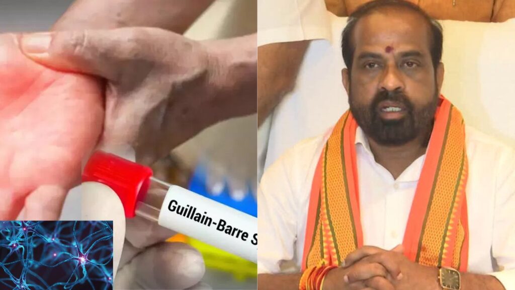 Guillain Barre Syndrome