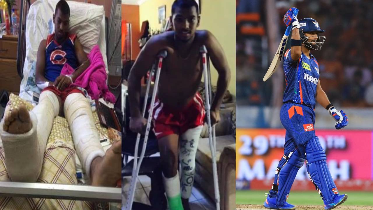 Nicholas Pooran : నికోలస్ పూరన్ గురించి ఈ విషయం తెలుసా..? పంత్ లాగానే యాక్సిడెంట్.. ఆటను వదులుకోవాలని డాక్టర్ల సలహా.. మొండి ధైర్యంతో.. Nicholas Pooran : నికోలస్ పూరన్ గురించి ఈ విషయం తెలుసా..? పంత్ లాగానే యాక్సిడెంట్.. ఆటను వదులుకోవాలని డాక్టర్ల సలహా.. మొండి ధైర్యంతో..