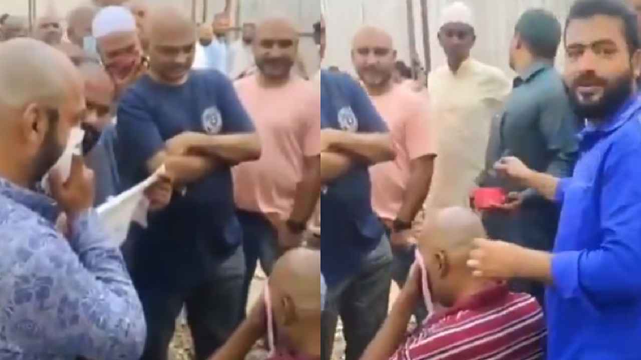 Hyderabad Bald Head : బట్టతలపై జుట్టు మొలిపిస్తానంటే టెంప్ట్ అయ్యారు, కట్ చేస్తే ఆసుపత్రి పాలయ్యారు..! హైదరాబాద్లో ఘరానా మోసం.. Hyderabad Bald Head : బట్టతలపై జుట్టు మొలిపిస్తానంటే టెంప్ట్ అయ్యారు, కట్ చేస్తే ఆసుపత్రి పాలయ్యారు..! హైదరాబాద్లో ఘరానా మోసం..