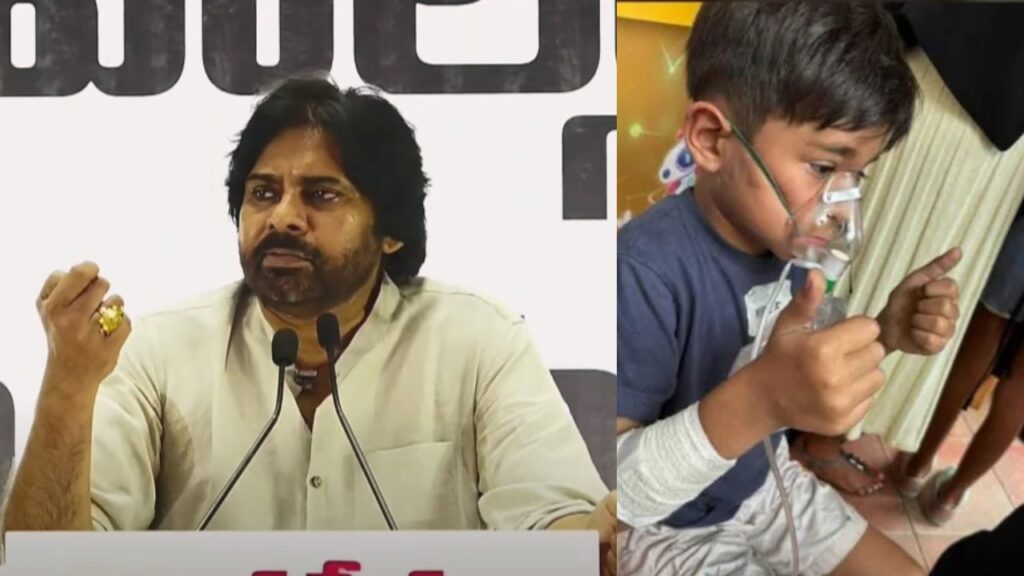 Pawan Kalyan Tells about his Son Mark Shankar Mental Condition after Fire Accident