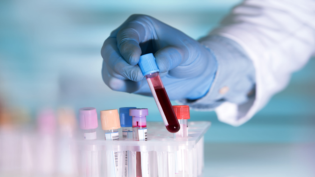 Artificial Blood: క్లినికల్ ట్రయల్స్ లో కృత్రిమ రక్తం.. జపాన్ శాస్త్రవేత్తల అద్భుత సృష్టి Artificial Blood: క్లినికల్ ట్రయల్స్ లో కృత్రిమ రక్తం.. జపాన్ శాస్త్రవేత్తల అద్భుత సృష్టి