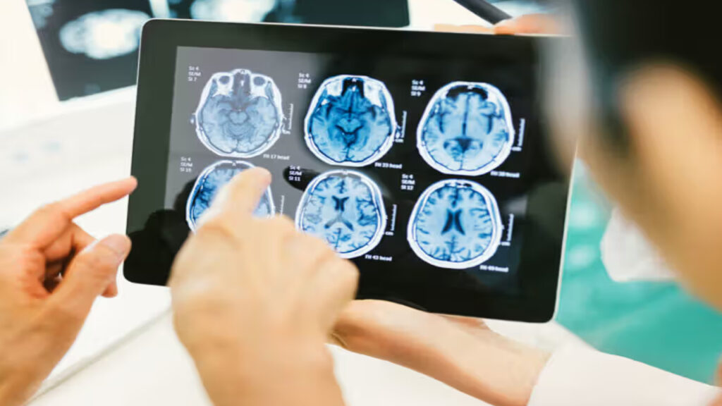 Cause of Brain tumer