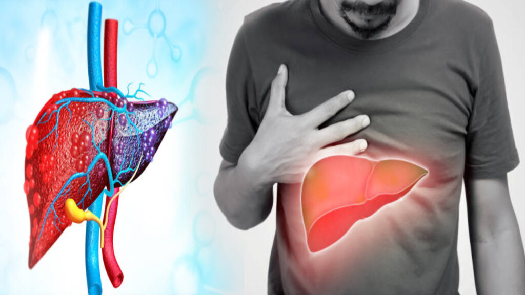 symptoms of fatty liver problem.
