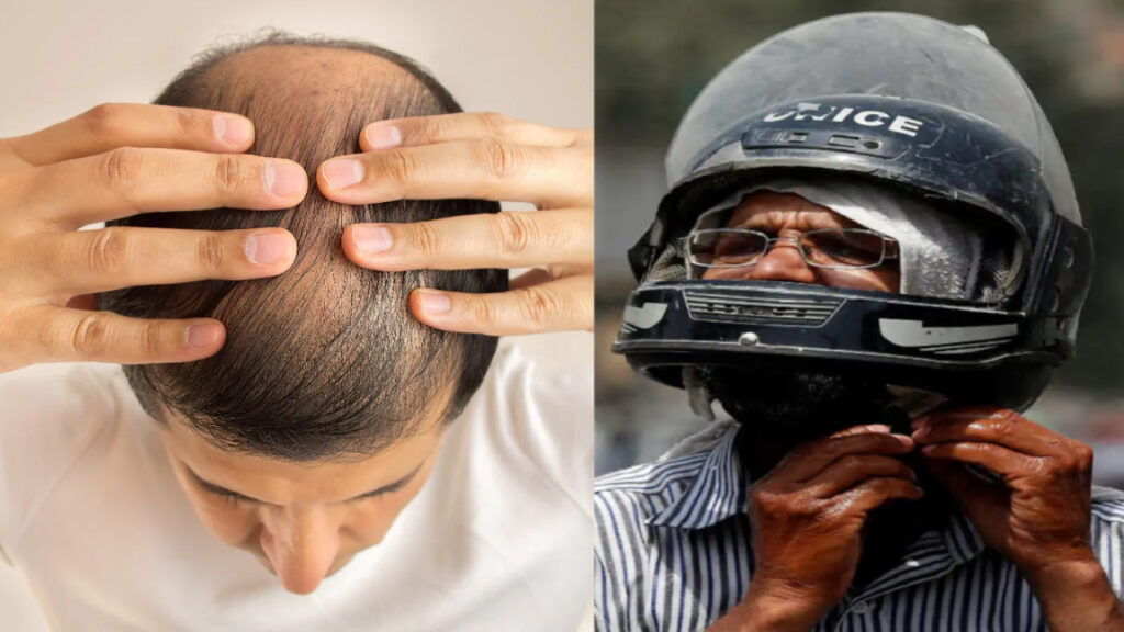 Hair loss