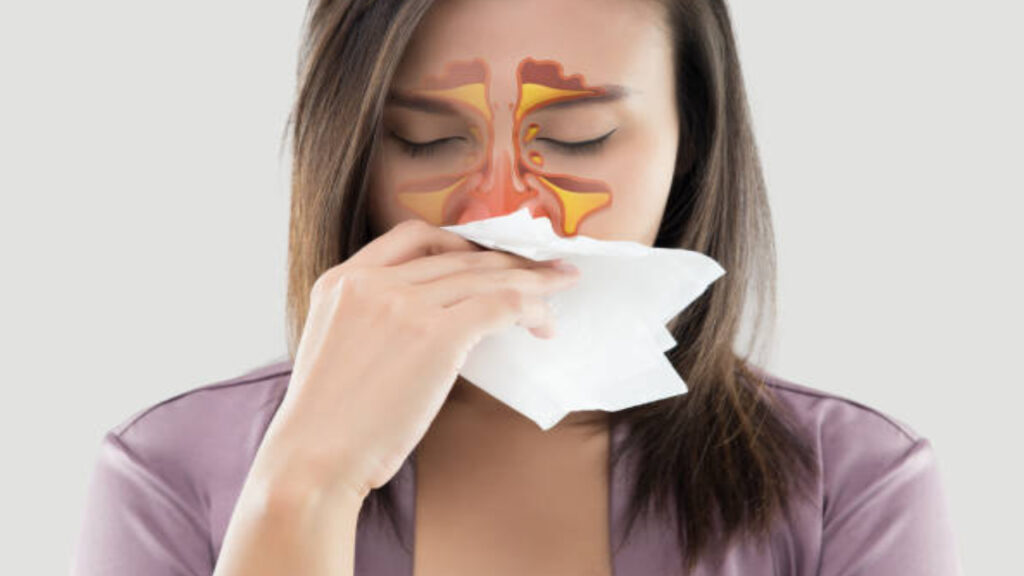 Sinusitis problems