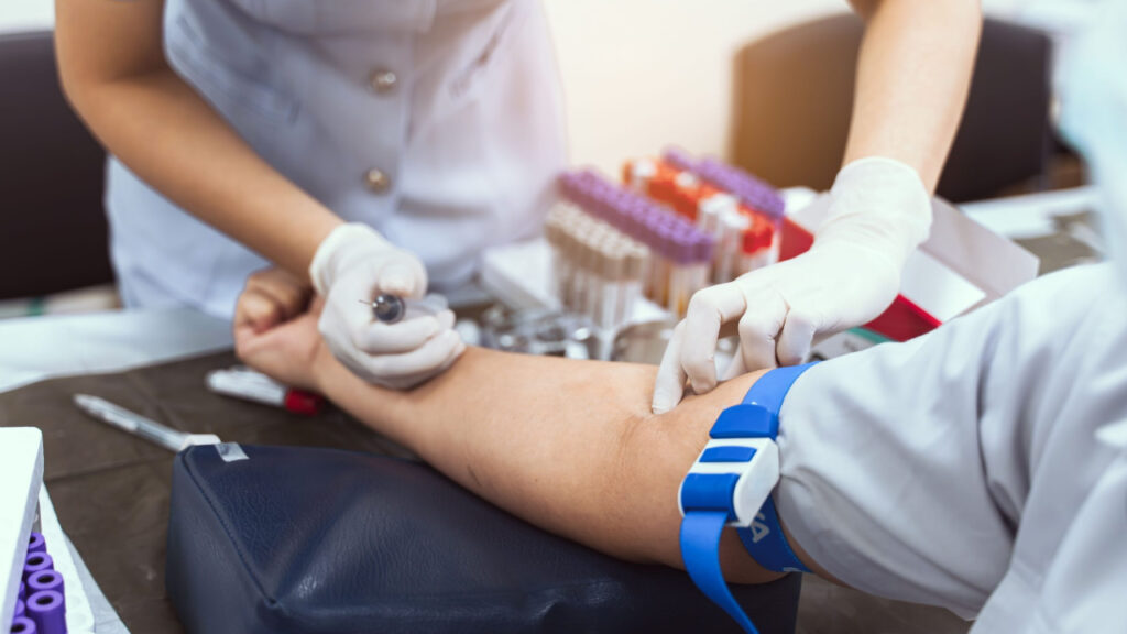 With CRP Blood test We can detect heart attack even before