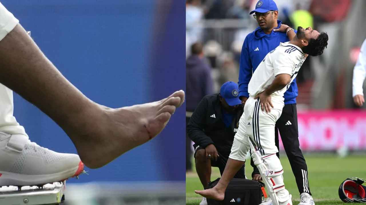 Rishabh Pant Injury : రిషబ్ పంత్ కు తీవ్ర గాయం.. నొప్పితో విలవిల.. కాలు ఉబ్బిపోయి నడవలేని స్థితిలో.. Rishabh Pant Injury : రిషబ్ పంత్ కు తీవ్ర గాయం.. నొప్పితో విలవిల.. కాలు ఉబ్బిపోయి నడవలేని స్థితిలో..