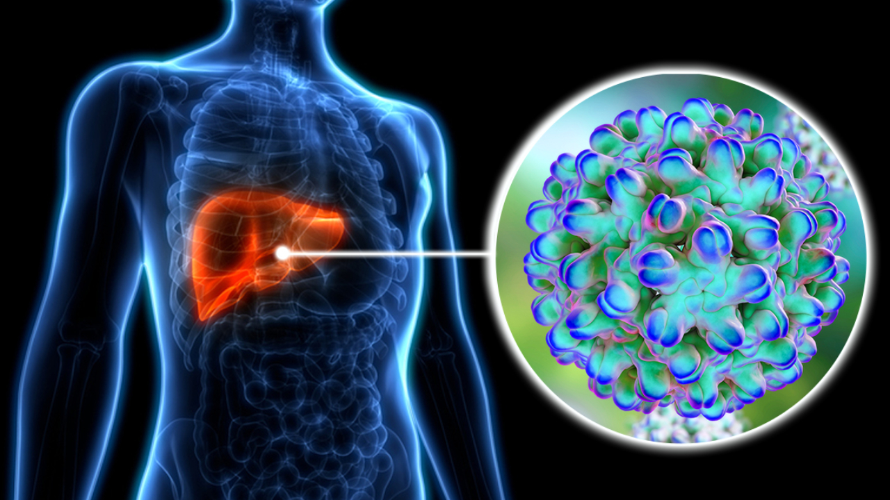 Hepatitis: వర్షాకాలంలో హెపటైటిస్ ప్రమాదం.. ఒకరి నుంచి మరొకరికి వ్యాపిస్తుంది.. జాగ్రత్తగా ఉండండి Hepatitis: వర్షాకాలంలో హెపటైటిస్ ప్రమాదం.. ఒకరి నుంచి మరొకరికి వ్యాపిస్తుంది.. జాగ్రత్తగా ఉండండి