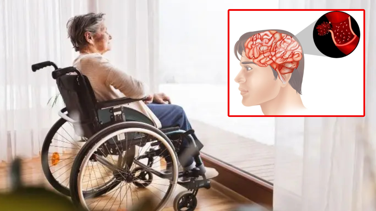 Paralysis Symptoms: పక్షవాతాన్ని ముందే గుర్తించండి.. లక్షణాలు ఇవే.. జాగ్రత్త పడండి Paralysis Symptoms: పక్షవాతాన్ని ముందే గుర్తించండి.. లక్షణాలు ఇవే.. జాగ్రత్త పడండి