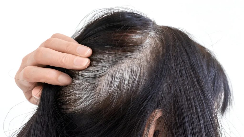 Hair Health: Here are 5 tips to turn white hair black