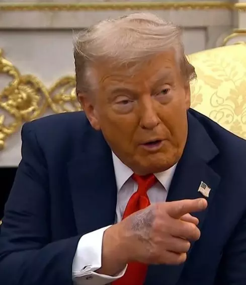 Trump hand black spot photo