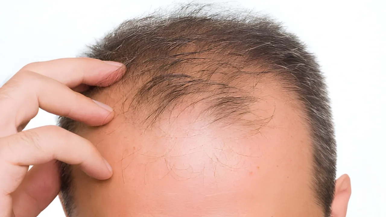 Taiwanese Hair Growth Serum